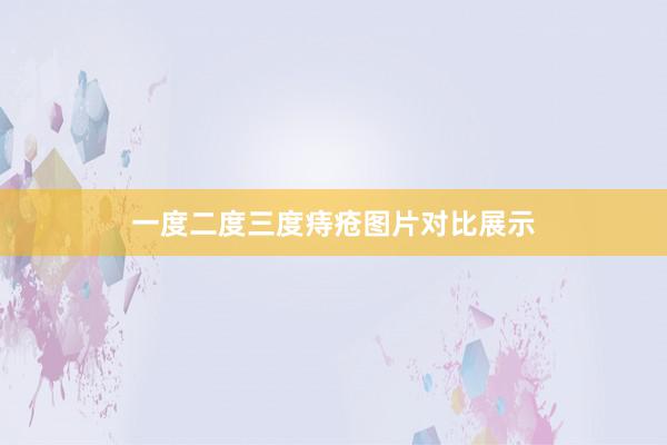 一度二度三度痔疮图片对比展示